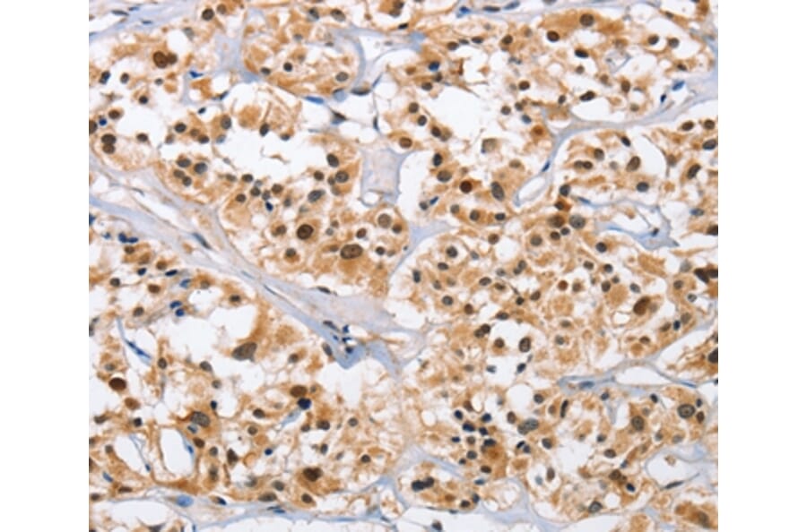 Immunohistochemistry - NCAPD3 Antibody from Signalway Antibody (36306) - Antibodies.com