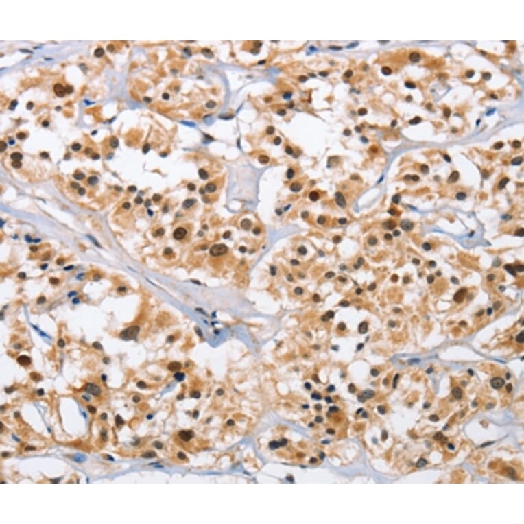 Immunohistochemistry - NCAPD3 Antibody from Signalway Antibody (36306) - Antibodies.com