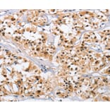 Immunohistochemistry - NCAPD3 Antibody from Signalway Antibody (36306) - Antibodies.com
