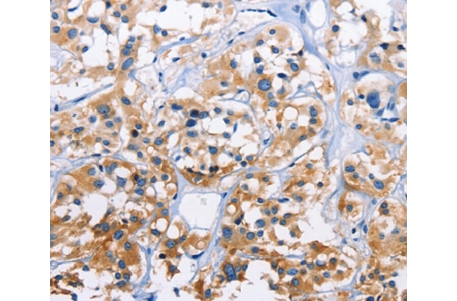 Immunohistochemistry - CAPZA3 Antibody from Signalway Antibody (36307) - Antibodies.com