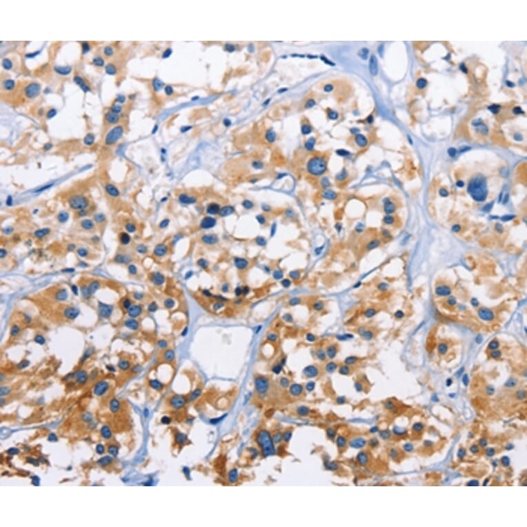 Immunohistochemistry - CAPZA3 Antibody from Signalway Antibody (36307) - Antibodies.com