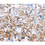 Immunohistochemistry - CAPZA3 Antibody from Signalway Antibody (36307) - Antibodies.com