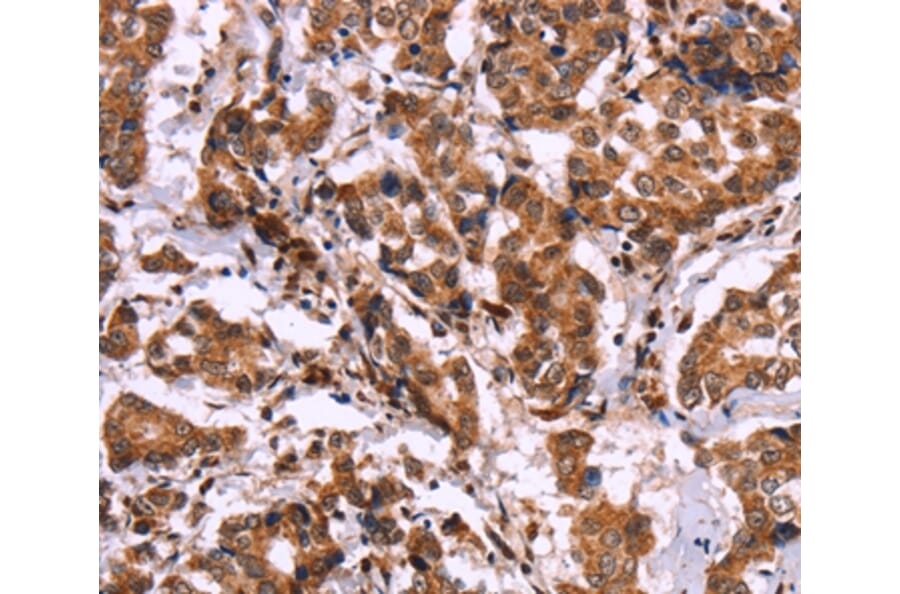 Immunohistochemistry - CARD11 Antibody from Signalway Antibody (36308) - Antibodies.com