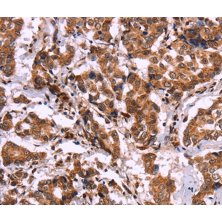 Immunohistochemistry - CARD11 Antibody from Signalway Antibody (36308) - Antibodies.com