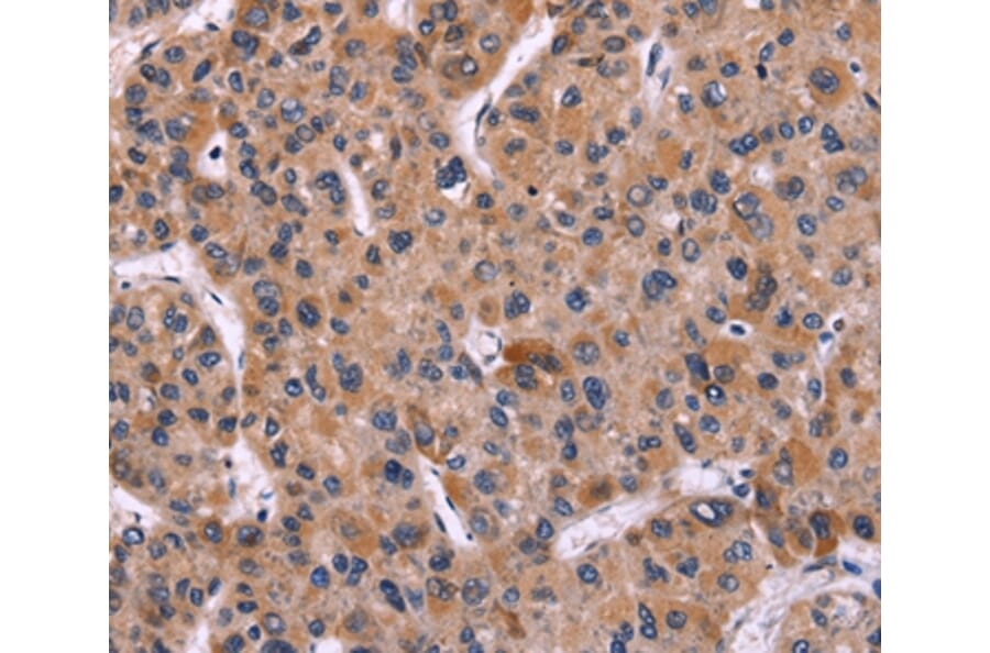 Immunohistochemistry - CARD11 Antibody from Signalway Antibody (36308) - Antibodies.com