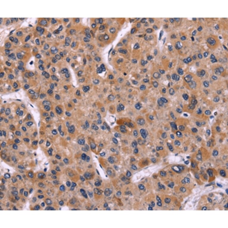 Immunohistochemistry - CARD11 Antibody from Signalway Antibody (36308) - Antibodies.com