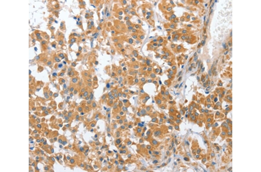 Immunohistochemistry - CHMP4B Antibody from Signalway Antibody (36350) - Antibodies.com
