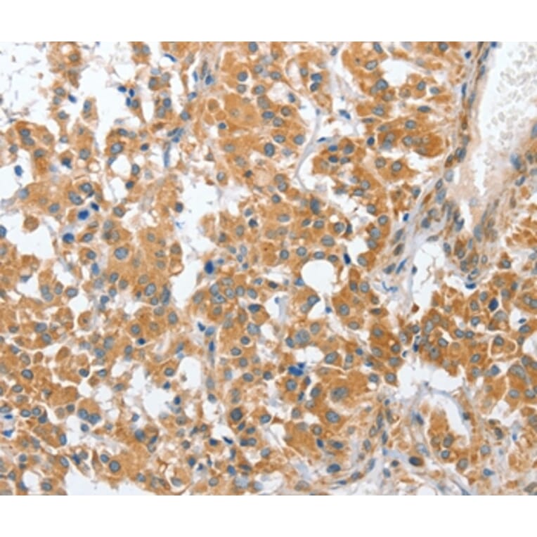 Immunohistochemistry - CHMP4B Antibody from Signalway Antibody (36350) - Antibodies.com