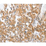 Immunohistochemistry - CHMP4B Antibody from Signalway Antibody (36350) - Antibodies.com