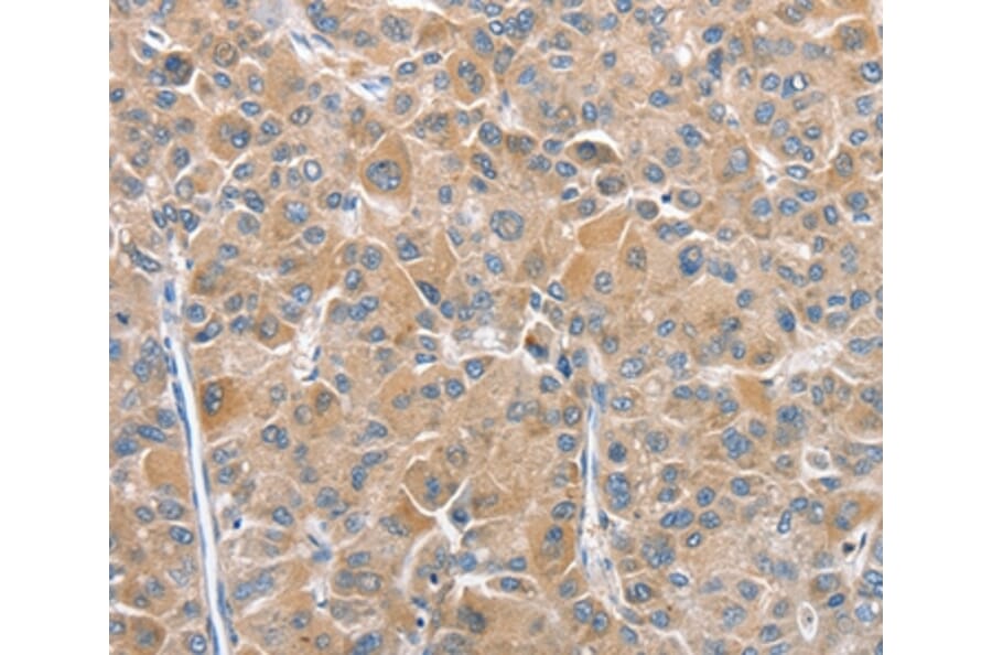 Immunohistochemistry - CHMP4B Antibody from Signalway Antibody (36350) - Antibodies.com