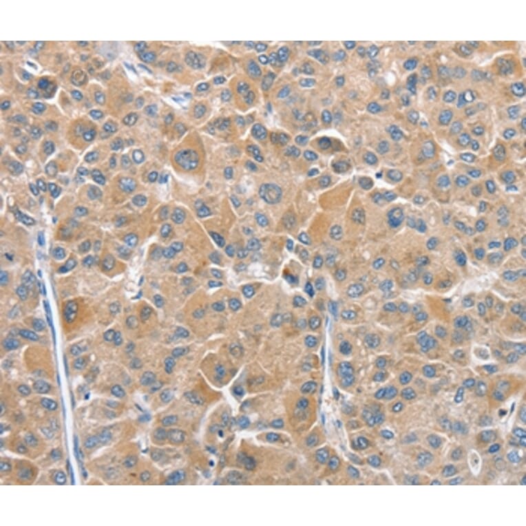 Immunohistochemistry - CHMP4B Antibody from Signalway Antibody (36350) - Antibodies.com