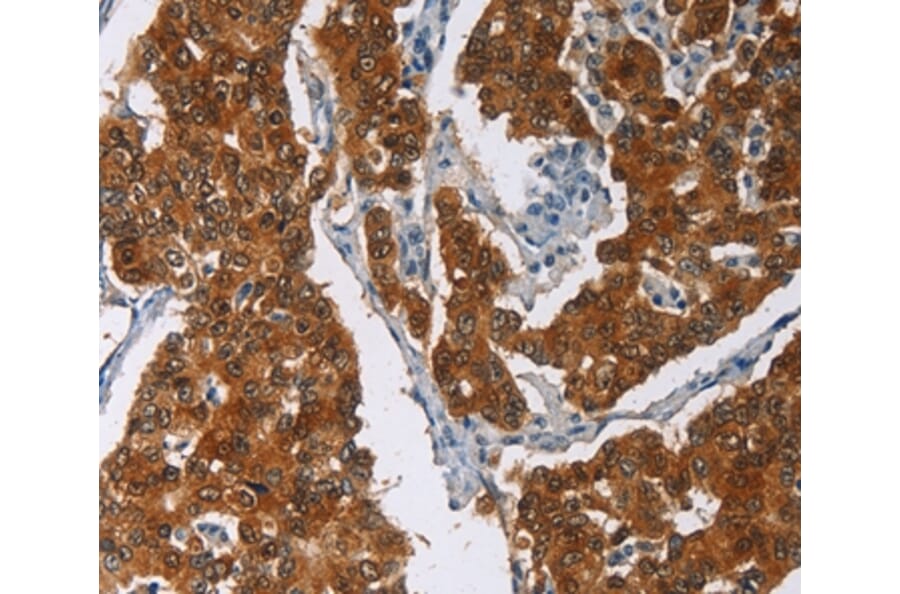 Immunohistochemistry - CRABP2 Antibody from Signalway Antibody (36368) - Antibodies.com