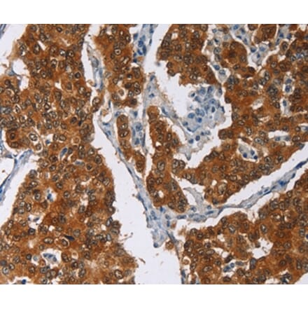 Immunohistochemistry - CRABP2 Antibody from Signalway Antibody (36368) - Antibodies.com