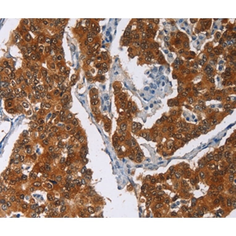 Immunohistochemistry - CRABP2 Antibody from Signalway Antibody (36368) - Antibodies.com