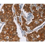 Immunohistochemistry - CRABP2 Antibody from Signalway Antibody (36368) - Antibodies.com