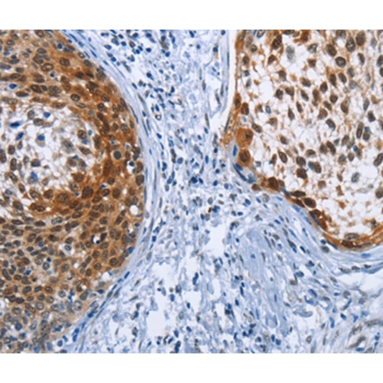 Immunohistochemistry - CRABP2 Antibody from Signalway Antibody (36368) - Antibodies.com