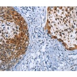 Immunohistochemistry - CRABP2 Antibody from Signalway Antibody (36368) - Antibodies.com