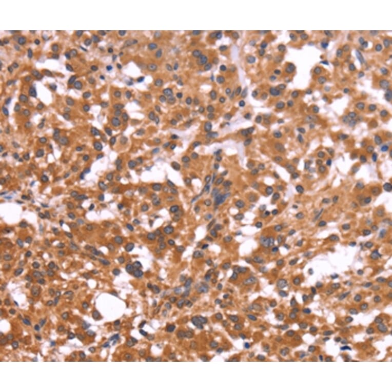 Immunohistochemistry - CRISP3 Antibody from Signalway Antibody (36371) - Antibodies.com