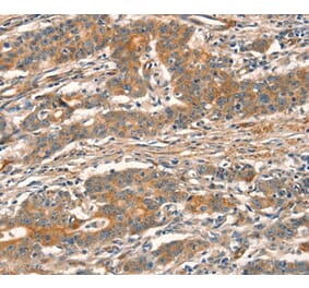Immunohistochemistry - CUEDC2 Antibody from Signalway Antibody (36379) - Antibodies.com