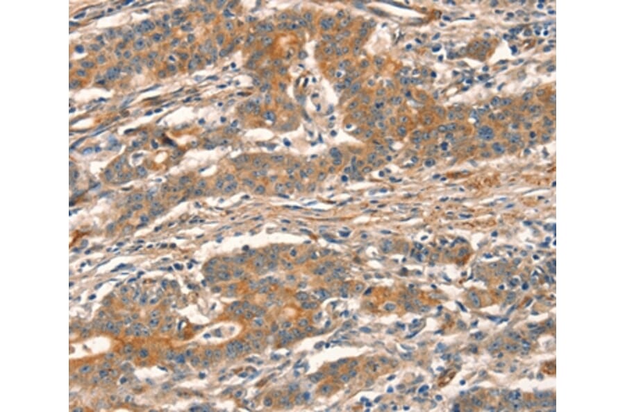 Immunohistochemistry - CUEDC2 Antibody from Signalway Antibody (36379) - Antibodies.com