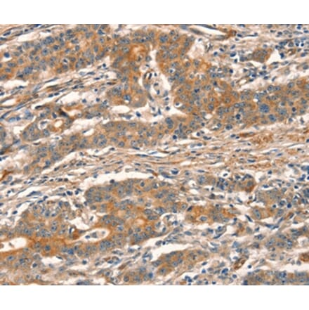 Immunohistochemistry - CUEDC2 Antibody from Signalway Antibody (36379) - Antibodies.com