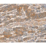 Immunohistochemistry - CUEDC2 Antibody from Signalway Antibody (36379) - Antibodies.com
