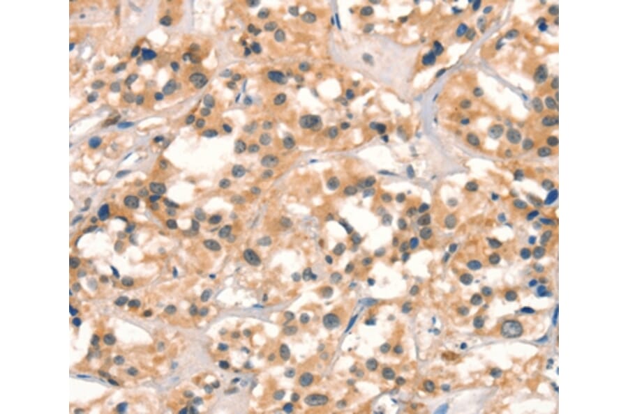 Immunohistochemistry - CUEDC2 Antibody from Signalway Antibody (36379) - Antibodies.com