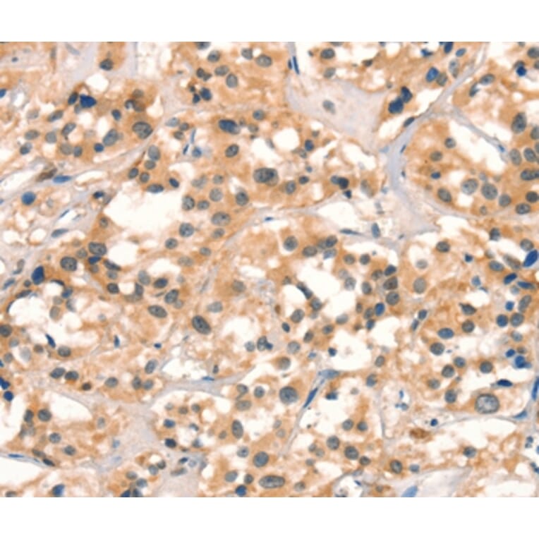Immunohistochemistry - CUEDC2 Antibody from Signalway Antibody (36379) - Antibodies.com