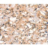 Immunohistochemistry - CUEDC2 Antibody from Signalway Antibody (36379) - Antibodies.com