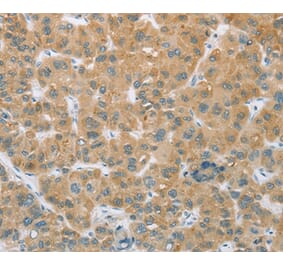 Immunohistochemistry - CYP2C9 Antibody from Signalway Antibody (36384) - Antibodies.com