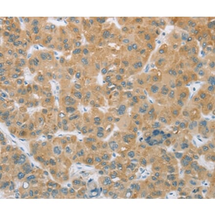 Immunohistochemistry - CYP2C9 Antibody from Signalway Antibody (36384) - Antibodies.com