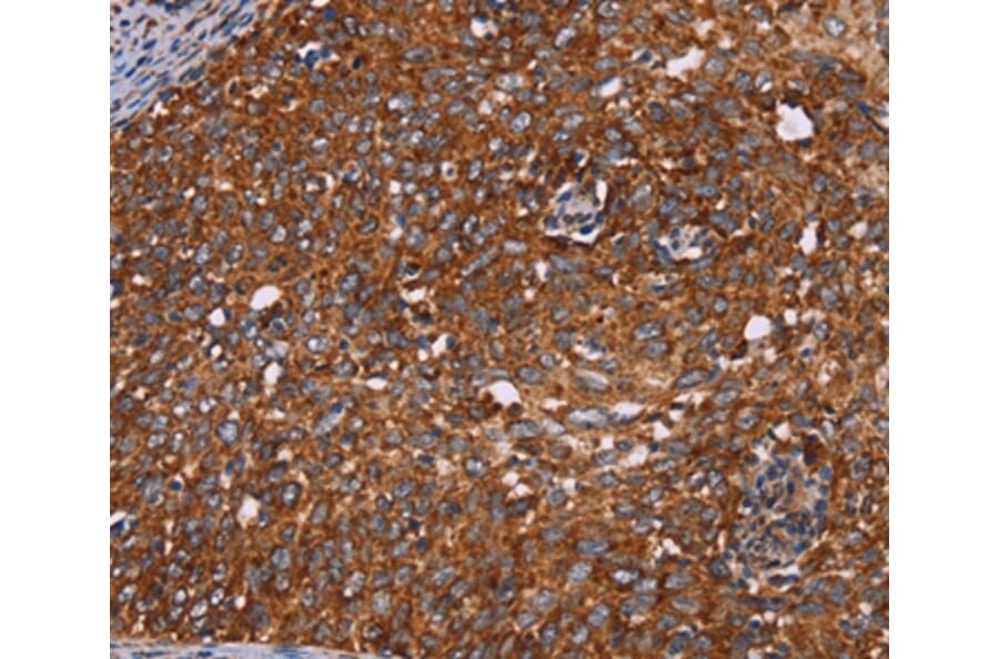 Immunohistochemistry - CYP2W1 Antibody from Signalway Antibody (36385) - Antibodies.com