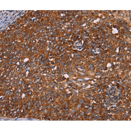 Immunohistochemistry - CYP2W1 Antibody from Signalway Antibody (36385) - Antibodies.com