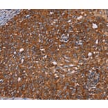 Immunohistochemistry - CYP2W1 Antibody from Signalway Antibody (36385) - Antibodies.com