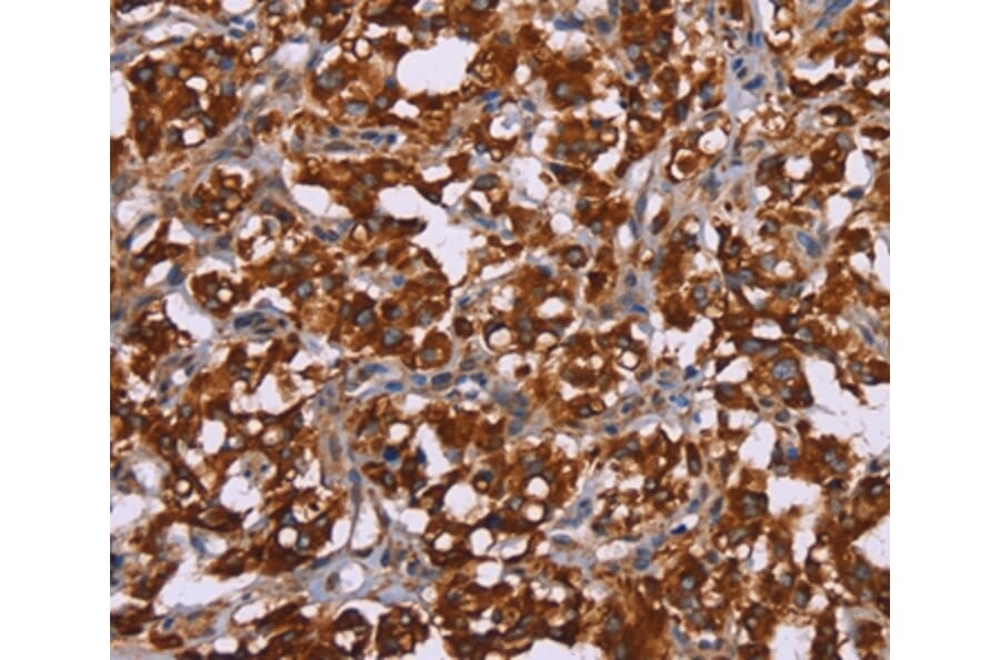 Immunohistochemistry - CYP2W1 Antibody from Signalway Antibody (36385) - Antibodies.com