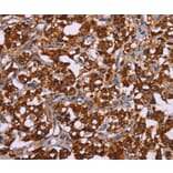 Immunohistochemistry - CYP2W1 Antibody from Signalway Antibody (36385) - Antibodies.com