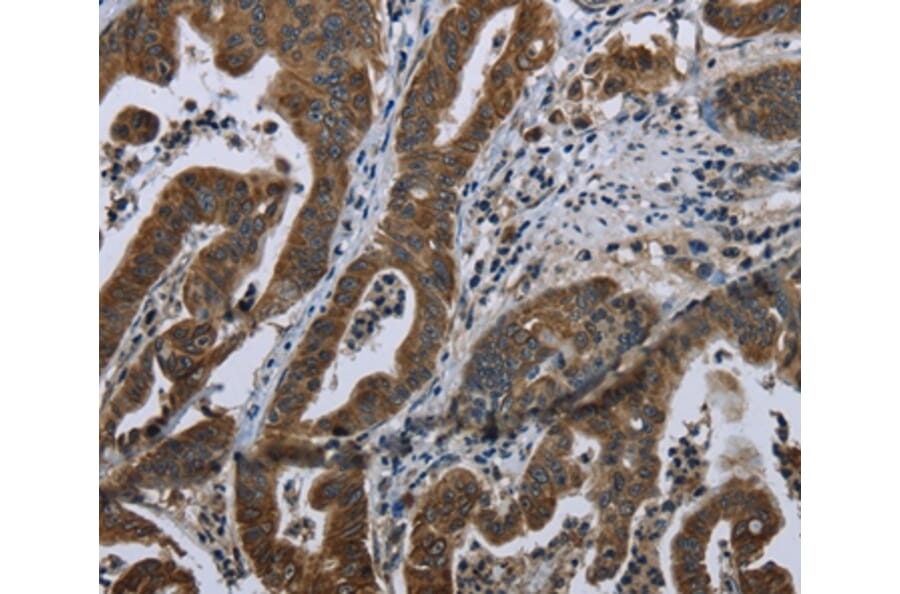 Immunohistochemistry - BRINP1 Antibody from Signalway Antibody (36400) - Antibodies.com