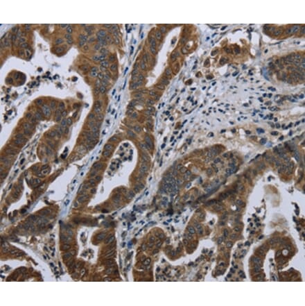 Immunohistochemistry - BRINP1 Antibody from Signalway Antibody (36400) - Antibodies.com