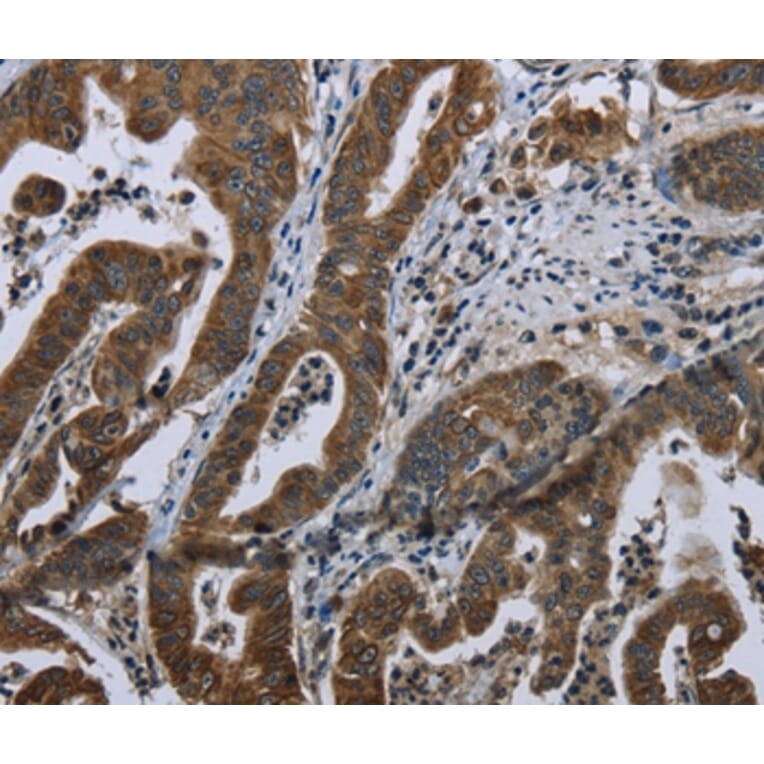 Immunohistochemistry - BRINP1 Antibody from Signalway Antibody (36400) - Antibodies.com