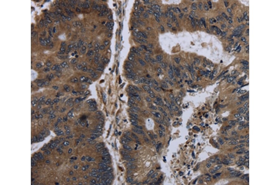Immunohistochemistry - BRINP1 Antibody from Signalway Antibody (36400) - Antibodies.com