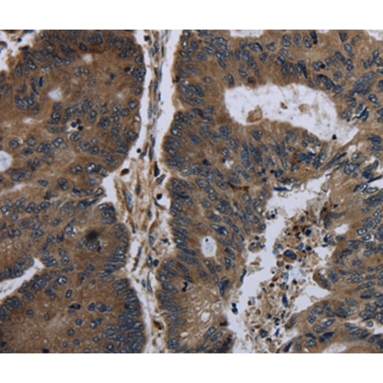 Immunohistochemistry - BRINP1 Antibody from Signalway Antibody (36400) - Antibodies.com