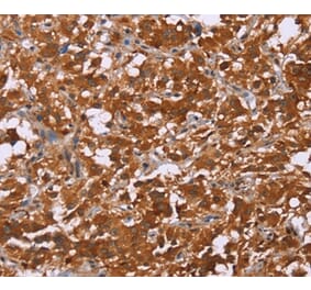 Immunohistochemistry - DCBLD2 Antibody from Signalway Antibody (36401) - Antibodies.com