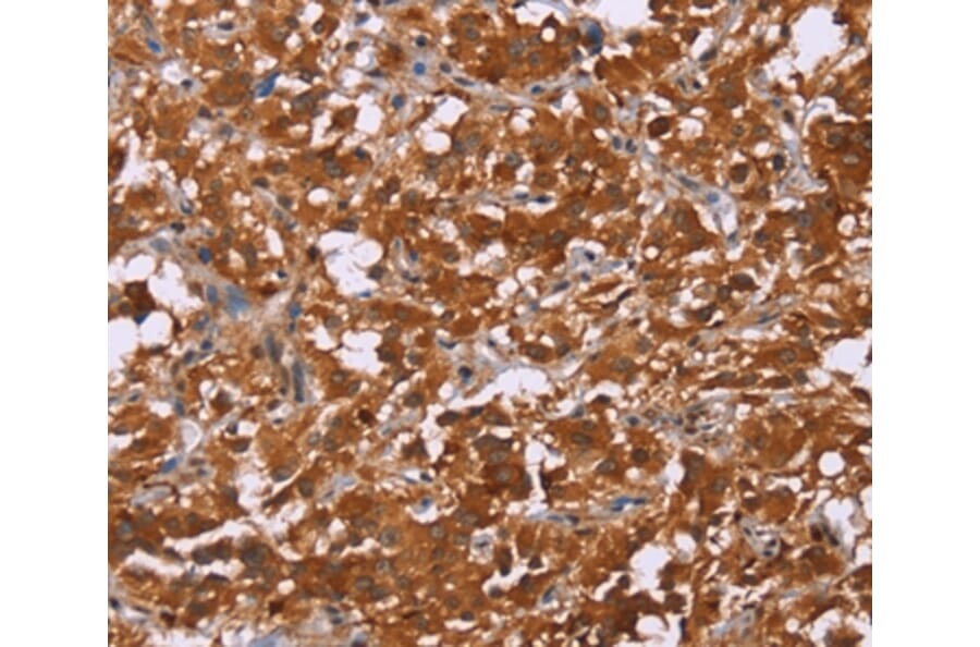 Immunohistochemistry - DCBLD2 Antibody from Signalway Antibody (36401) - Antibodies.com