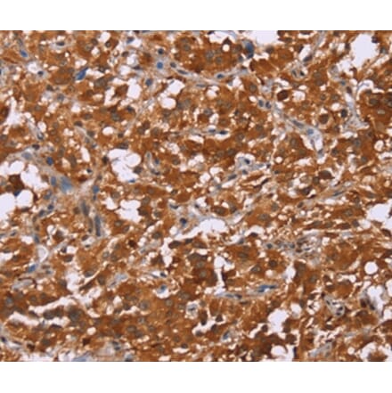 Immunohistochemistry - DCBLD2 Antibody from Signalway Antibody (36401) - Antibodies.com