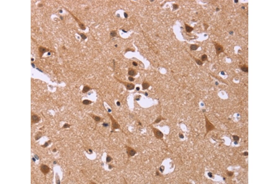 Immunohistochemistry - DCBLD2 Antibody from Signalway Antibody (36401) - Antibodies.com