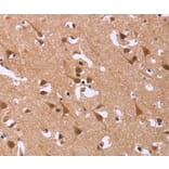 Immunohistochemistry - DCBLD2 Antibody from Signalway Antibody (36401) - Antibodies.com