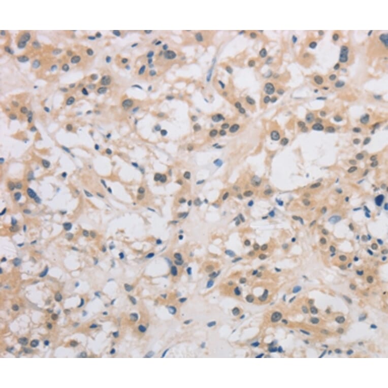 Immunohistochemistry - DDIT4L Antibody from Signalway Antibody (36408) - Antibodies.com