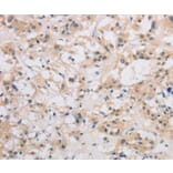 Immunohistochemistry - DDIT4L Antibody from Signalway Antibody (36408) - Antibodies.com