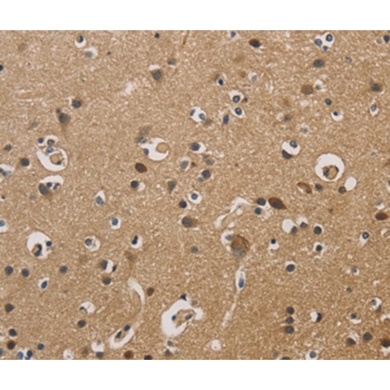 Immunohistochemistry - DUSP23 Antibody from Signalway Antibody (36426) - Antibodies.com