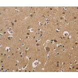 Immunohistochemistry - DUSP23 Antibody from Signalway Antibody (36426) - Antibodies.com